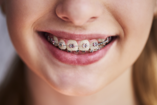 ORTHODONTICS